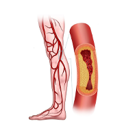 Vascular Surgery